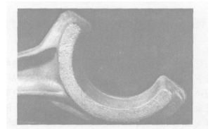 Fig. 4 Surface chap on la rge head