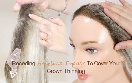 Frontal Hair Loss Solution | Receding Hairline Topper To Cover Your Crown Thinning